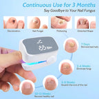 1pcs Effective Rechargeable Nail Fungus Remover Nail Fungus Cleaning Laser Device Repair Damaged Discolored Thick Fingernails
