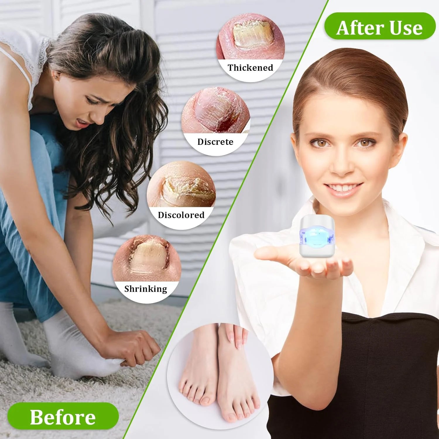 1pcs Effective Rechargeable Nail Fungus Remover Nail Fungus Cleaning Laser Device Repair Damaged Discolored Thick Fingernails