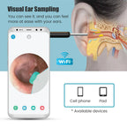 Wireless Visual Ear Pick Camera Ear Wax Removal Tool Picker Ear Cleaner Wax Removal  Earwax Cleaning Endoscope Kit Spoon Earpick