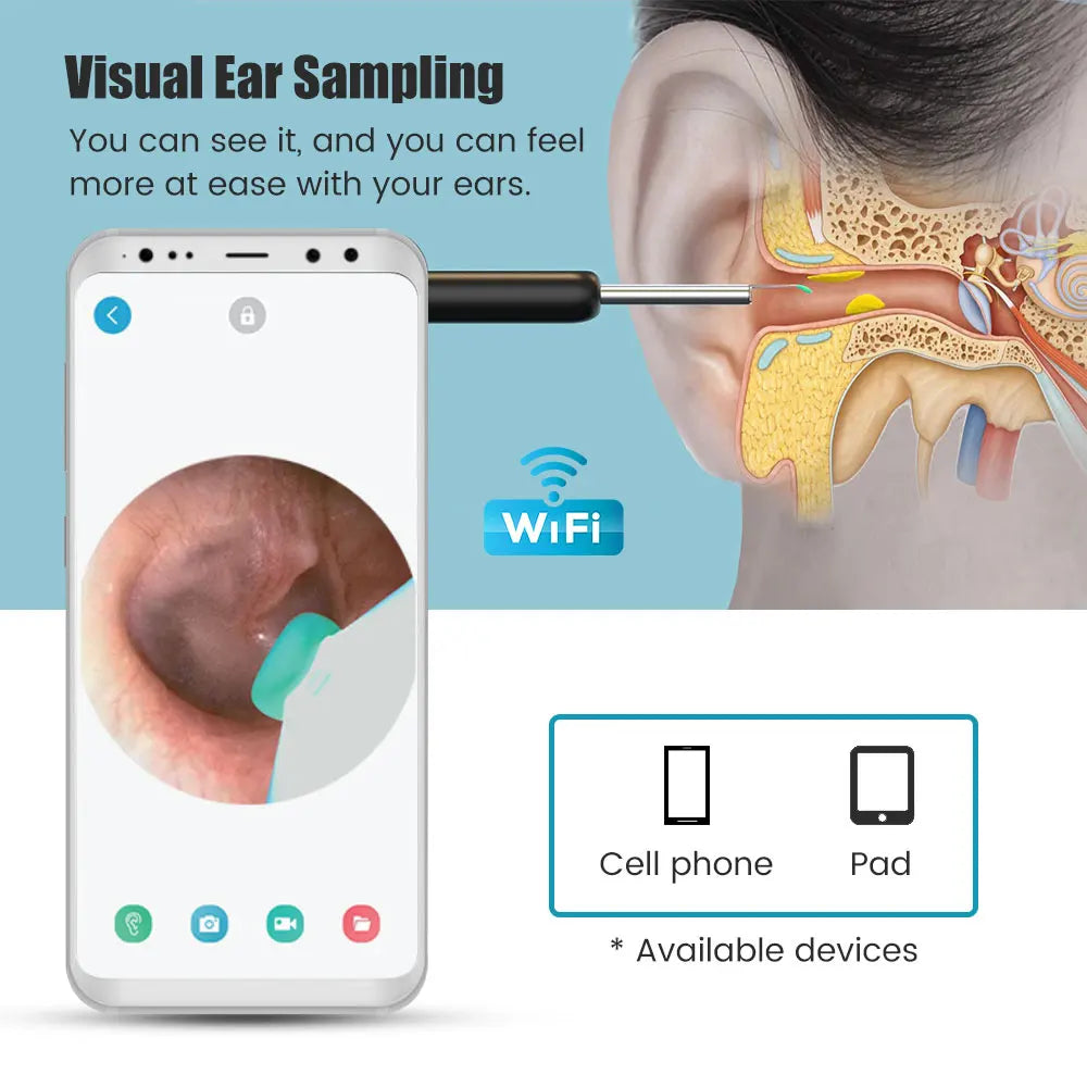 Wireless Visual Ear Pick Camera Ear Wax Removal Tool Picker Ear Cleaner Wax Removal  Earwax Cleaning Endoscope Kit Spoon Earpick